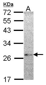 NME5 Antibody (aa1-212)
