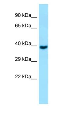 GNA11 Antibody (aa193-242)