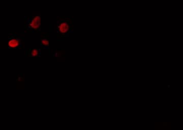 ORAOV1 Antibody