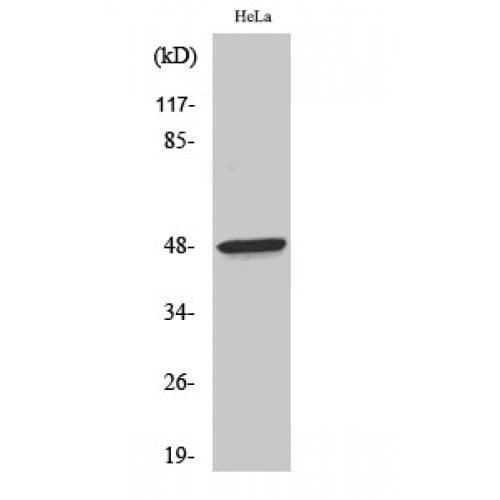 F2R / Thrombin Receptor / PAR1 Antibody (10-90 aa, N-terminal)