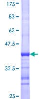 Human KAT2B / PCAF Protein (Recombinant GST, N-terminus)