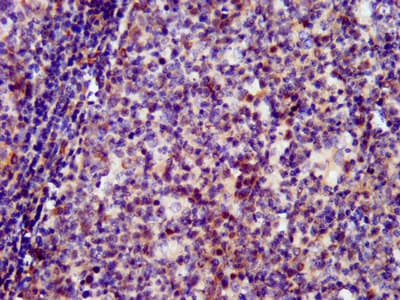 Polyclonal Rabbit anti-Human SIN3B Antibody (IHC, IF)