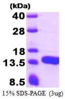 Human ATPIF1 / ATPI Protein (Recombinant His)