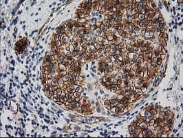 CTNNB1 / Beta Catenin Antibody (clone OTI1B11)
