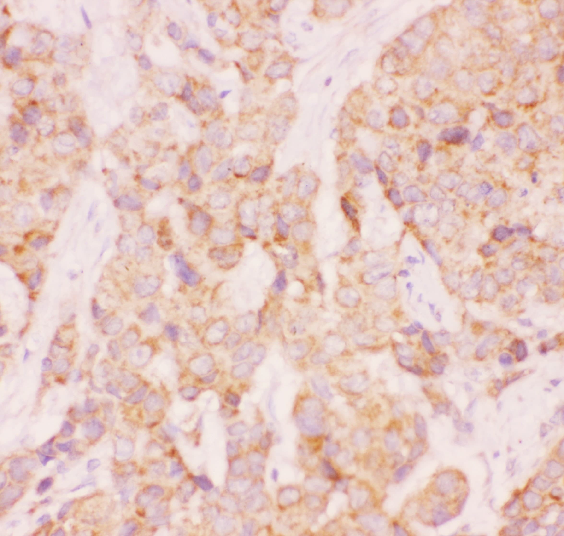 AAMP Antibody (aa235-434)