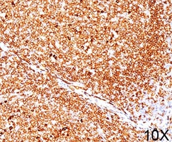 CD79A / CD79 Alpha Antibody (aa202-216, clone JCB117, Ready-to-Use)
