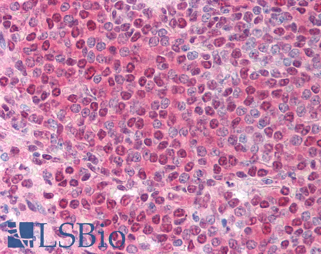 IHC-plus™ Polyclonal Rabbit anti-Human BUB3 Antibody (IHC, IF, WB)