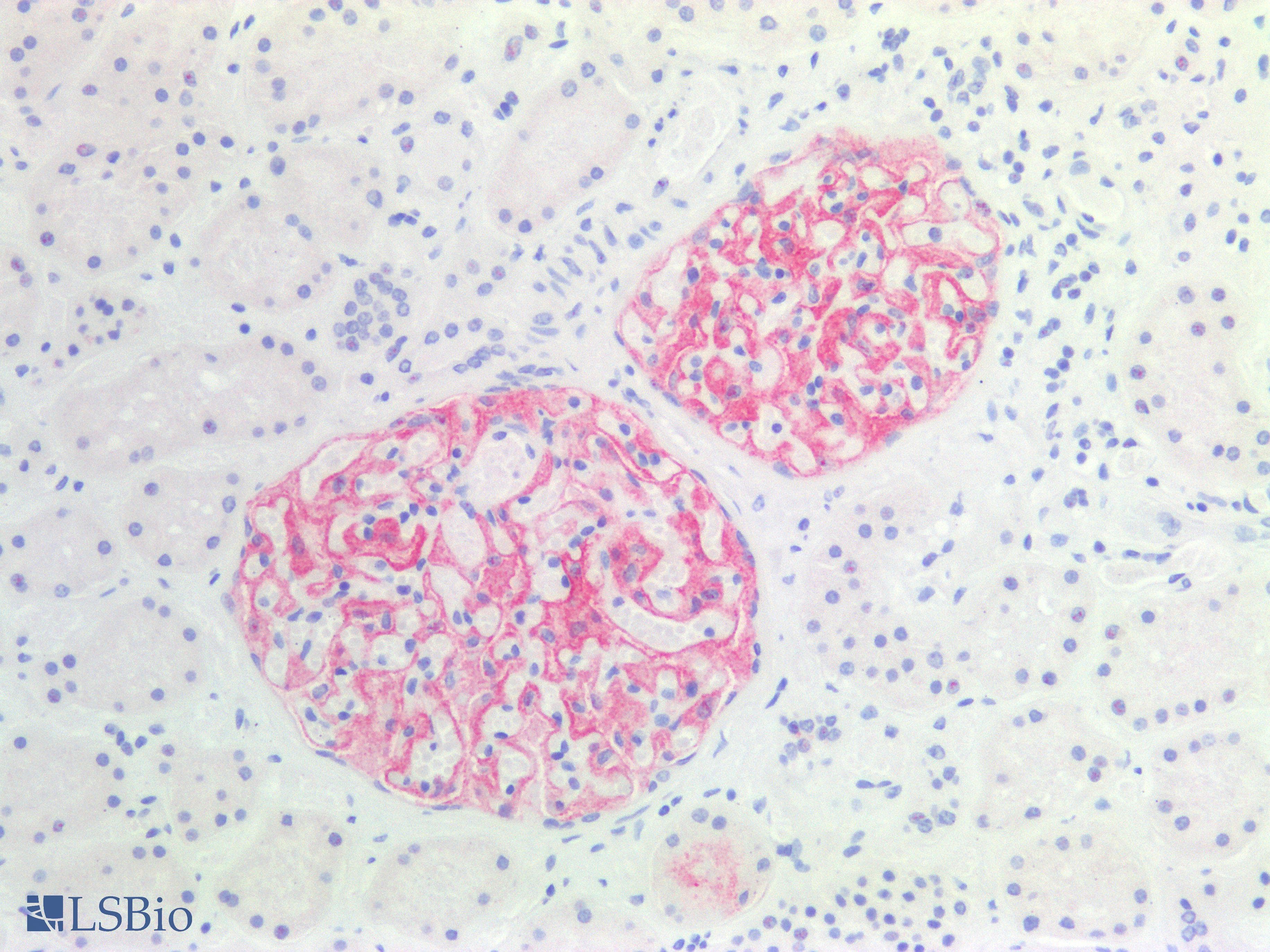 PathPlus™ Monoclonal Mouse anti-Human CR1 / CD35 Antibody (IHC)