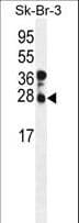 CHMP4B Antibody (aa51-79)