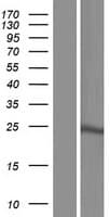 GH2 Protein (Over-Expression Lysate Myc-DDK (Flag))
