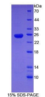 Human SHBG Protein (Recombinant His-S)