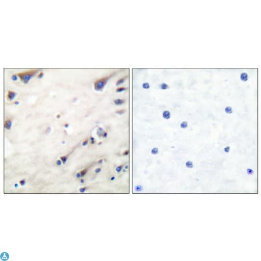 KSR1 Antibody