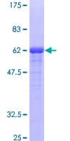 Human FVT1 / KDSR Protein (Recombinant GST)