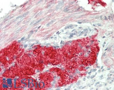 IHC-plus™ INHBB / Inhibin Beta B Antibody (Internal)
