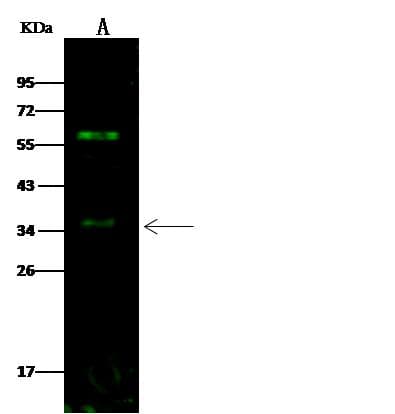 ADRB3 Antibody (Preservative Free)
