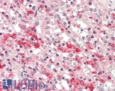 IHC-plus™ LIPA / Lysosomal Acid Lipase Antibody (clone 1F9)