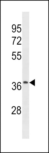 OR52J3 Antibody (aa283-311)