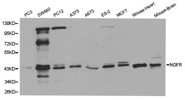 NGFR / CD271 / TNR16 Antibody