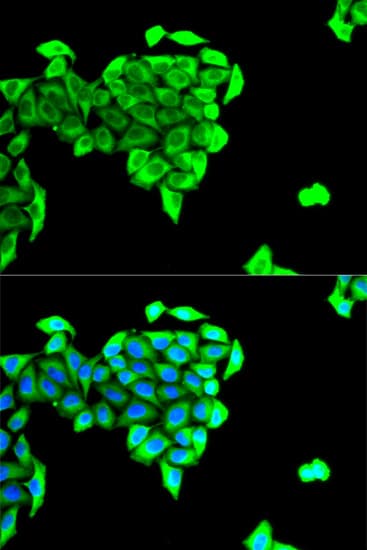 BAIAP2 / IRSP53 Antibody
