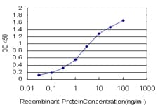 FOXM1 Antibody (clone 3A9)