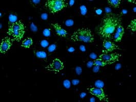 AK4 / Adenylate Kinase 4 Antibody (clone OTI5B10)