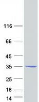 Human ARPIN / C15orf38 Protein (Recombinant Myc-DDK (Flag))