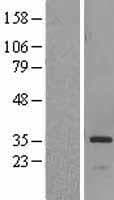 HSD17B6 Protein (Over-Expression Lysate Myc-DDK (Flag))