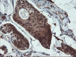 PYCARD / ASC / TMS1 Antibody (clone OTI3E9, Carrier-free)