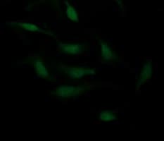 IHC-plus™ CDH3 / P-Cadherin Antibody (clone 2D5)
