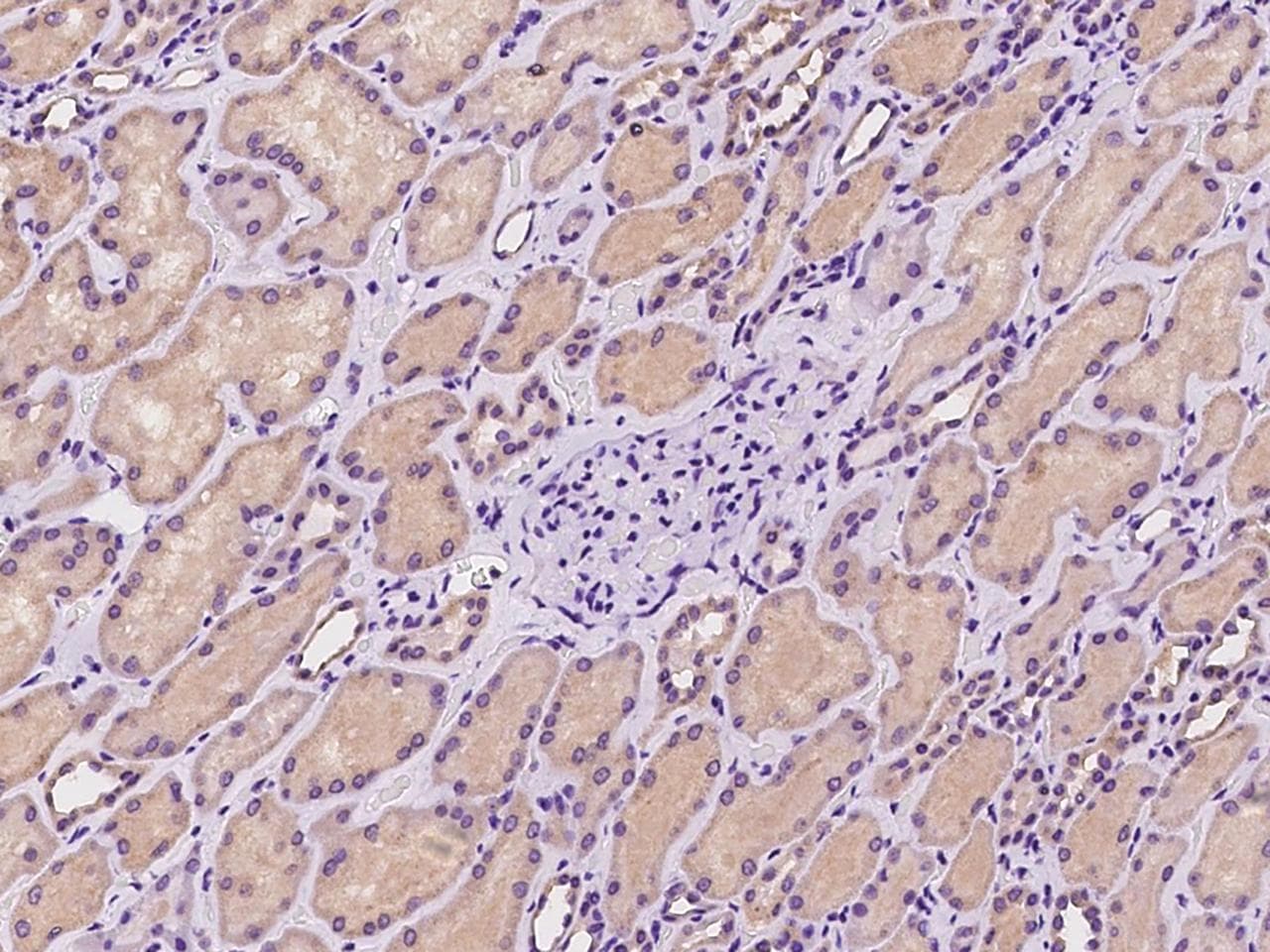 Polyclonal Rabbit anti-Human ADCK4 Antibody (IHC, IF)