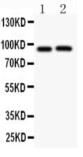 KCNB1 / Kv2.1 Antibody (aa687-858)