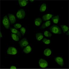 Monoclonal Mouse anti-Human TBL1XR1 / TBLR1 Antibody (IHC, WB)