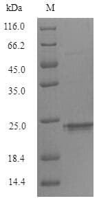 Mouse TREM2 / TREM-2 Protein (Recombinant 6His, N-terminus)