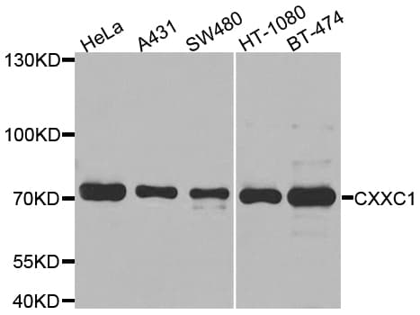 IHC-plus™ Polyclonal Rabbit anti-Human CXXC1 / CGBP Antibody (IHC, IF, WB)