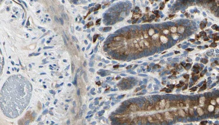 ADRA2A Antibody