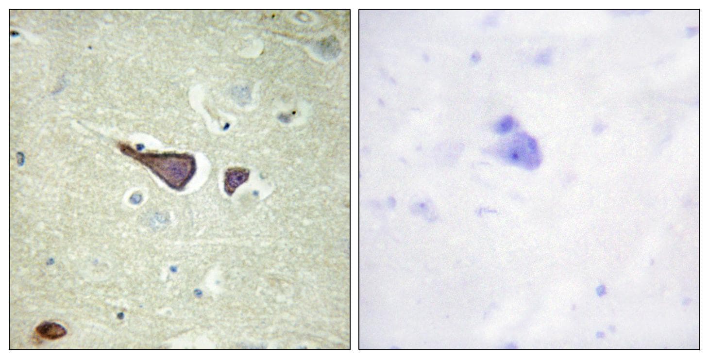 IGF2R / CD222 Antibody (Ab-2409)