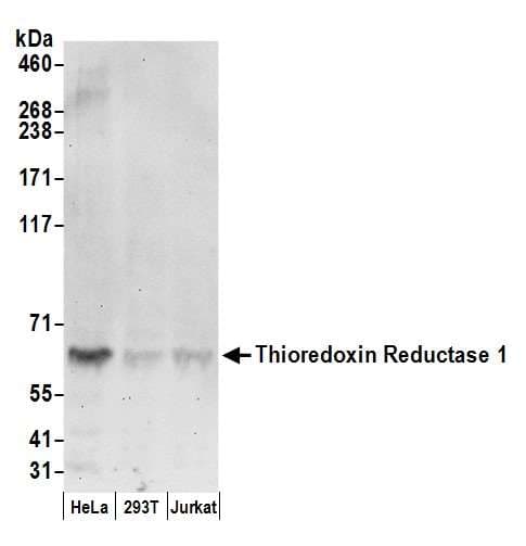 TRXR1 / TXNRD1 Antibody (aa125-175)