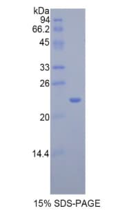 Rat IL17RB Protein (Recombinant His)