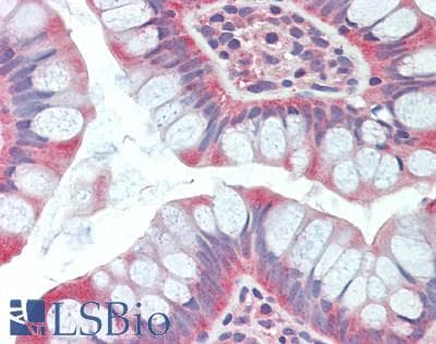 IHC-plus™ GSDMB / Gasdermin-Like Antibody