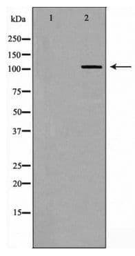 Polyclonal Rabbit anti-Human EPHB4 / EPH Receptor B4 Antibody (IHC, WB)
