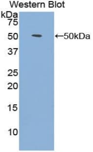 Polyclonal Rabbit anti-Human FGF1 / Acidic FGF Antibody (Biotin, aa1-155, WB)