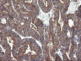 PDIA3 / ERp57 Antibody (aa140-505, clone OTI4D7)
