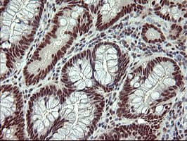RAPGEF1 Antibody (clone OTI2F5)