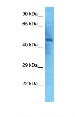 NEK2 Antibody (aa130-179)