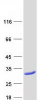 Human MOCS2 Protein (Recombinant Myc-DDK (Flag))