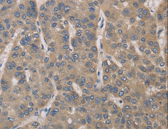 IRAK4 / IRAK-4 Antibody