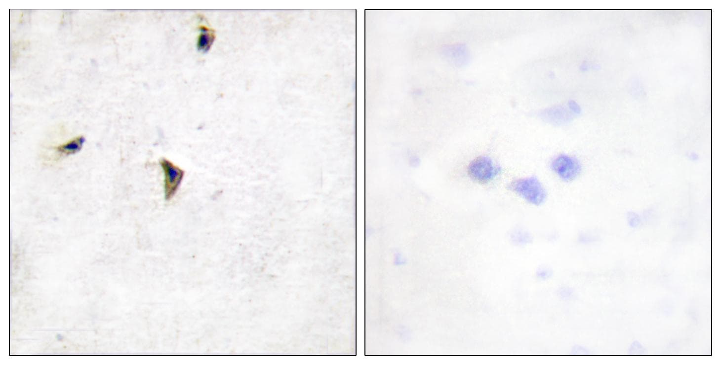 KCNB1 / Kv2.1 Antibody (Ab-567)