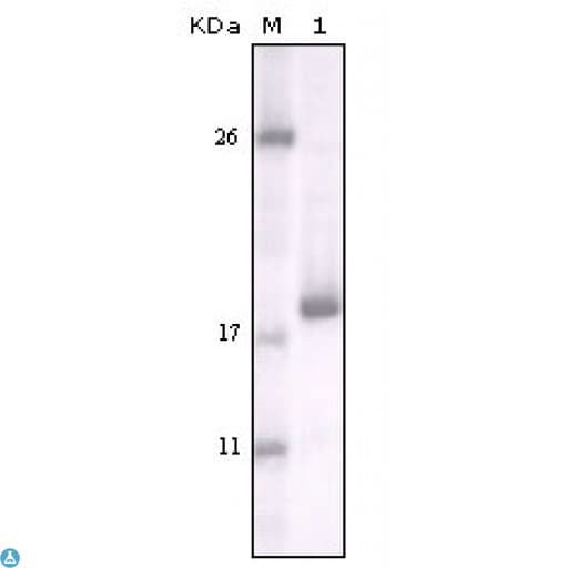 DDR2 Antibody