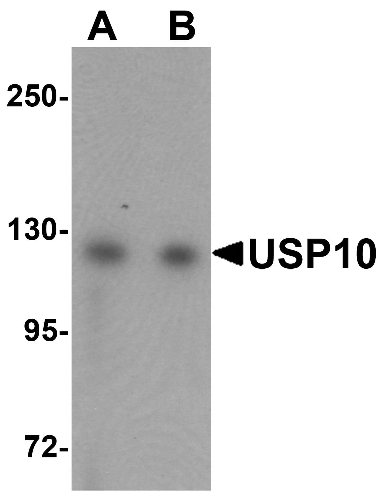 IHC-plus™ Polyclonal Rabbit anti-Human USP10 Antibody (IHC, IF, WB)