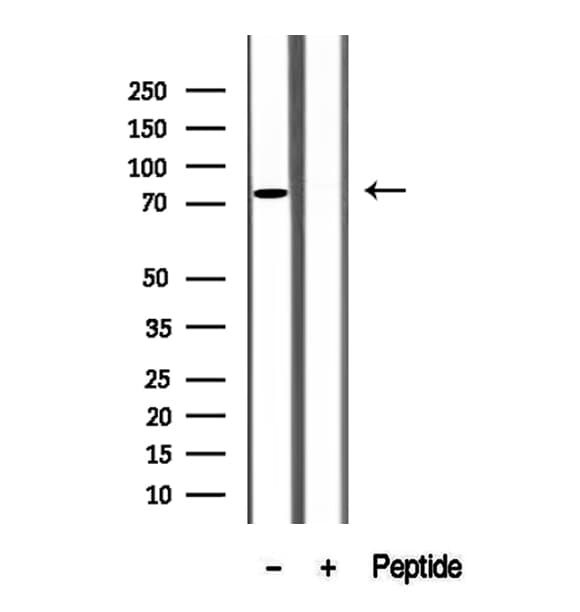 Polyclonal Rabbit anti-Human SH3KBP1 / CIN85 Antibody (IHC, IF, WB)